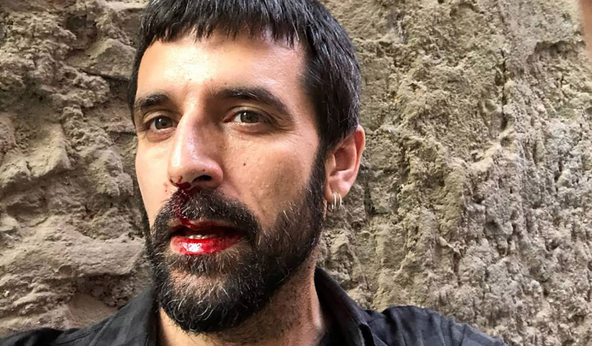 Jordi Borràs, quan va ser agredit pel policia espanyol